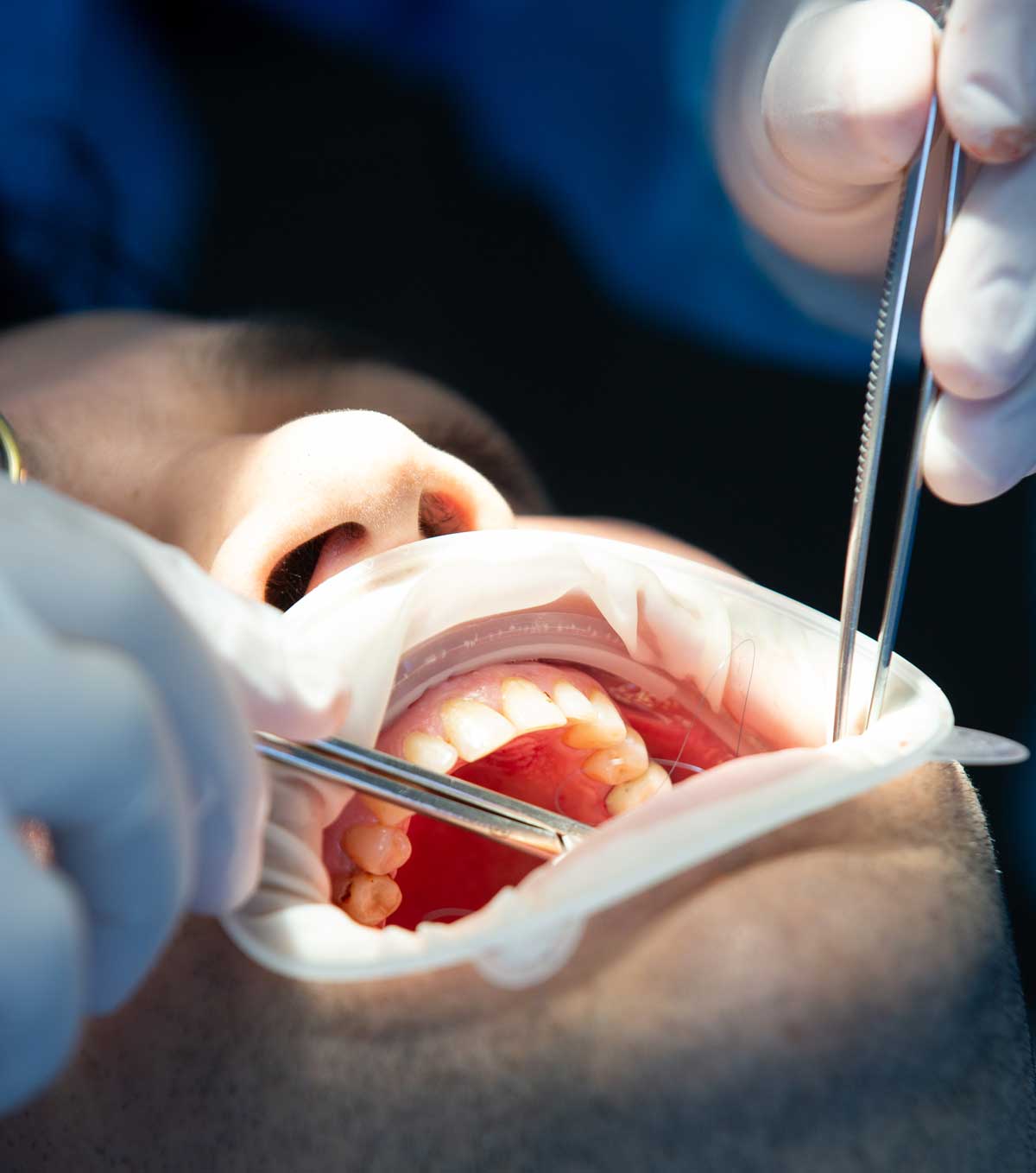 Cirurgias odontológicas