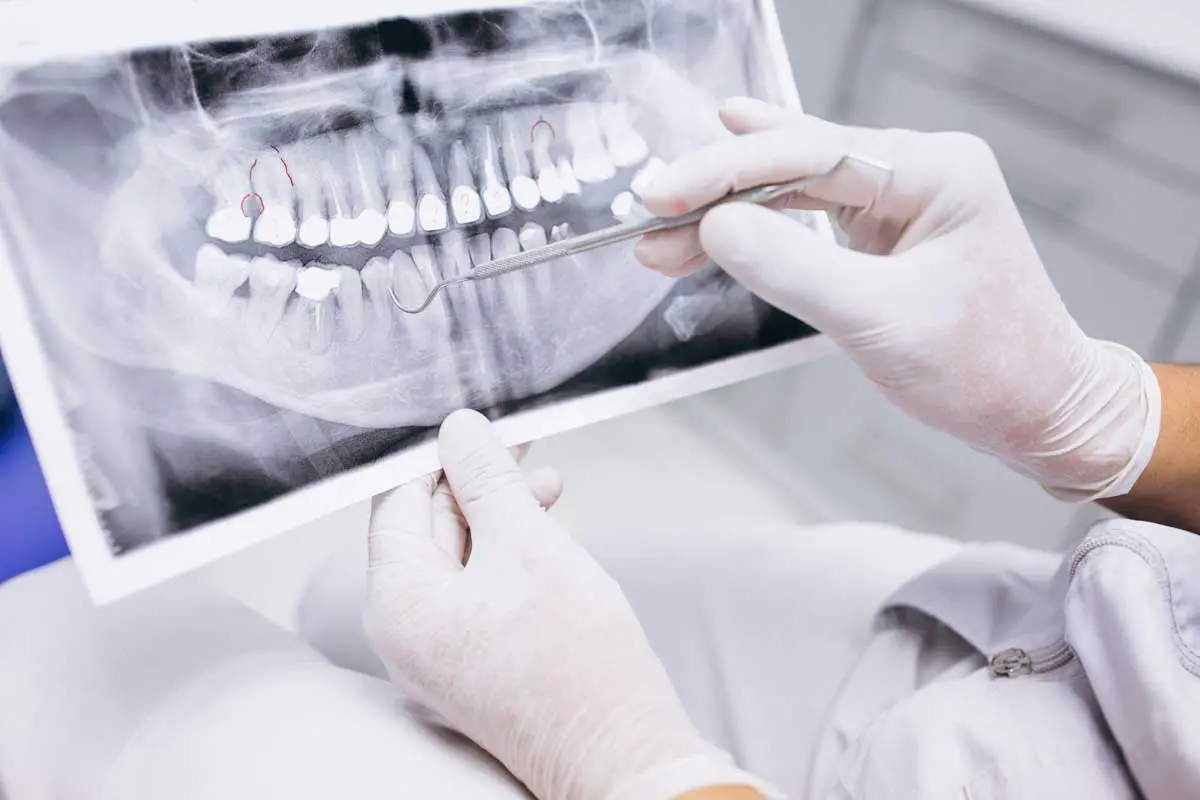 Exame odontológico para endodontia
